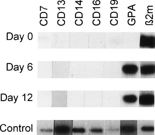 Fig. 10. RT-PCR products from CD34+Lin− cells, unilineage erythroid differentiating cells and single sorted cells using primers recognizing lineage-specific markers linked to differentiation. Autoradiographs are shown. At days 0, 6, and 12, the mRNA from 100 cells was isolated and processed as described in Materials and Methods. The cDNA derived from 100 cells was divided into 7 aliquots and each aliquot was processed for RT-PCR using primers recognizing CD7 (pre-T/T cells), CD13 (myelomonocytic cells), CD14 (monocytic cells), CD16 (NK cells), CD19 (pre-B/B cells), GPA (erythroid cells), or β2-microglobulin (β2m). Day 0: freshly purified CD34+Lin− cells isolated by positive/negative selection (MiniMACS). Day 6: CD34+Lin− cells from unilineage erythroid cultures as described in Materials and Methods. Day 12: CD34+Lin− cells induced to unilineage erythroid differentiation. Control: RT-PCR sensitivity testing. Each hybridization signal represents RT-PCR products from mRNA corresponding to 0.5 cell equivalents of flow cytometry sorted cells that expressed CD7, CD13, CD14, CD16, CD19, or GPA. The outermost right band represents the β2-microglobulin RT-PCR product of a single sorted CD34+CD38− cell. Note the absence of nonerythroid CD7, CD13, CD14, CD16, and CD19 transcripts in erythroid differentiating cells at days 6 and 12 of unilineage erythroid culture.