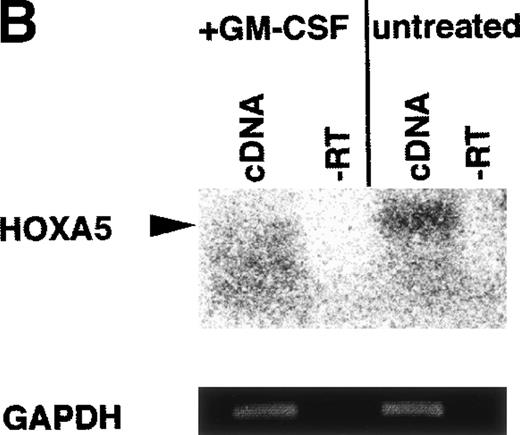 Fig. 1. (A) No significant difference is seen in the viability of CD34+ cells treated with or without GM-CSF for 72 hours, as measured by colony-forming ability. (B) GM-CSF treatment of CD34+ cells reduces expression of HOX A5 mRNA. cDNAs from GM-CSF–treated and untreated populations were amplified with GAPDH- and HOX A5-specific primers. GAPDH products are visualized by ethidium bromide staining, and HOX A5 products are visualized by Southern blotting with a HOX A5-specific32P-labeled probe. Controls containing mock cDNA reactions are labeled as “−RT.” The diffuse signal below the HOX A5 band is hybridization of the probe to the PCR primers. (C) Titration experiment demonstrating the parallel linear increase in signal relative to the concentration of input mRNA. Semiquantitative PCR was conducted as described in Materials and Methods.
