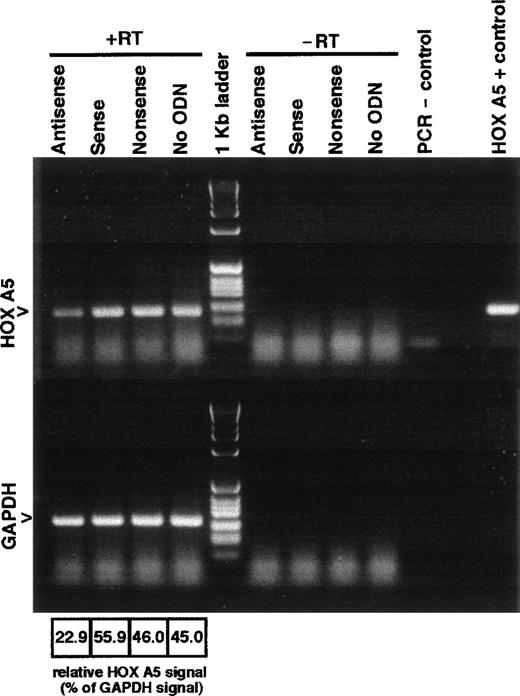 Fig. 2. Antisense ODN to HOX A5 decrease levels of HOX A5 mRNA. K562 cells transduced to overexpress HOX A5 are treated with 15 μmol/L of antisense, sense, nonsense (scrambled antisense), or no ODN for 24 hours. Lanes 1 through 4 (+RT) contain cDNAs generated from each treatment and were subjected to PCR amplification with HOX A5- and GAPDH-specific primers. Lanes 6 through 10 (−RT) contain HOX A5 and GAPDH PCR products of mock cDNA reactions lacking reverse transcriptase. Ethidium bromide-stained gels were digitally scanned, and relative intensities of HOX A5 product bands compared with their corresponding GAPDH bands are denoted below the lanes.