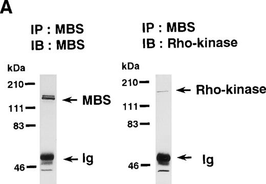 Fig. 1. In vitro phosphorylation of platelet MBS and inactivation of myosin phosphatase by Rho-kinase. (A) Coimmunoprecipitation of Rho-kinase with platelet MBS. Immunoprecipitates with anti-MBS antibodies were immunoblotted with antibodies against MBS (left) and Rho-kinase (right). IP, immunoprecipitation antibodies used; IB, immunoblotting antibodies used; Ig, cross-reacted Ig. (B) In vitro phosphorylation of platelet MBS. MBS immunoprecipitates from platelet lysates were incubated without RhoA, with GDP-RhoA, and with GTPγS-RhoA for 30 seconds, as described in Materials and Methods. Protein phosphorylation was analyzed by SDS-PAGE, followed by autoradiography. (C) Inhibitory effect of HA1077 and Y-27632 on GTPγS-RhoA–dependent phosphorylation of platelet MBS. Different concentrations of HA1077 (left panel) or Y-27632 (right panel) were included in the reaction mixture, and MBS phosphorylation was analyzed, as described in Materials and Methods. Results were expressed as the percentage of the value, without the addition of compounds. The results are representative of three independent experiments. (D) Effects of HA1077 and Y-27632 on the activity of myosin phosphatase derived from MBS immunoprecipitates in the presence of GTPγS-RhoA. MBS immunoprecipitates were incubated with 20 μmol/L HA1077 or 10 μmol/L Y-27632 in the presence of GTPγS-RhoA for 30 seconds, and the activity of myosin phosphatase was determined immediately. The value shows the mean ± SE from three experiments. *P < .05 (E) Effects of various compounds on GTPγS-RhoA–dependent phosphorylation of platelet MBS. Immunoprecipitates with anti-MBS antibody from platelet lysates were incubated for 30 seconds with 10 nmol/L M-1, 10 nmol/L yohimbine, 100 nmol/L ONO-3708, 100 nmol/L KT5926, or 50 μmol/L W-7 in the presence of GTPγS-RhoA, as described in Materials and Methods. Protein phosphorylation was analyzed by SDS-PAGE, followed by autoradiography. Similar results were obtained in three other experiments.