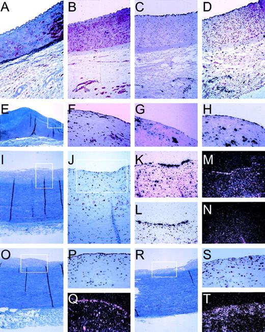 Fig. 5. Pattern of in situ hybridization of mRNA expression in human vascular tissue. In situ hybridization and immuno-histochemical staining was performed on serial sections (5 μm) of formaline-fixed and paraffin-embedded vascular tissue as described in Materials and Methods. Tissues were derived from the normal iliac artery of a 12-year-old male (A through D), 0.5 cm past the aortic bifurcation and the abdominal aorta of a 49-year-old woman (E through H), or a 39-year-old woman (I through T), both 1 cm before the bifurcation. (A) Masson Trichrome staining showing an overview through the iliac artery with the lumen on top, endothelial cells lining the vessel wall, the internal elastic lamina, the smooth muscle cell-containing media, and the spongy-appearing adventitia. (B) Specific staining of smooth muscle cells, using an antibody directed against SMC-specific -actin (1A4). (C) Autoradiographic image of the specific hybridization of an antisense probe for the endothelial cell specific protein von Willebrand factor, showing the integrity of endothelial cell mRNA and specificity of hybridization conditions. (D) Expression of novel cDNA CG12_1 is restricted to endothelial cells lining the vessel and the capillaries of the adventitia, identical to von Willebrand factor (C). (E) Masson Trichrome staining showing an overview through the aorta with the lumen on top, endothelial cells lining the vessel wall, a fibrous neo-intima (blue), the internal elastic lamina, the smooth muscle cell-containing media (purple), and the spongy-appearing adventitia. The boxed area is represented in (F) through (H). (F) Immunohistochemical staining using a monocyte/macrophage-specific antibody (HAM-56), showing the presence of extensive infiltration of the neointimal layer of the vessel wall, indicative of an inflammatory lesion. (G) Specific expression of MCP-1 by both macrophages and endothelial cells in this inflamed vessel wall. (H) Specific expression of ferritin by monocytes/macrophages and endothelial cells. (I) Masson Trichrome staining showing an overview through the aorta with the lumen on top, endothelial cells lining the vessel wall, a fibrous neo-intima (gray), the internal elastic lamina, the smooth muscle cell-containing media (blue/purple), and the spongy-appearing adventitia. The boxed area is represented in (J). (J) Immunostaining for macrophages (HAM-56) in this aorta section showing inflammation of the intima; the boxed area is represented in the in situ hybridizations shown in (K) through (N). (K) Expression pattern of MCP-1 in endothelial cells and macrophage/foam cells. (L) Specific expression of CA2_1 (hIAP-1) by the endothelial cells. (M) Expression of novel cDNA GG2_1 by endothelial cells. (M) and (N) are a darkfield representation of the autoradiographic images for greater clarity of hybridization of radiolabeled probes for sense mRNA for novel cDNA GG2_1 (M) and, as control for specificity, for antisense GG2_1 (N). (O) Masson Trichrome staining showing an overview through the aorta with the lumen on top, endothelial cells lining the vessel wall, a fibrous neo-intima (gray), the internal elastic lamina, the smooth muscle cell-containing media (blue/purple), and the spongy-appearing adventitia. (P) The integrity of the endothelial cell lining is shown with the specific lectin from Ulex europaeus, and specific expression of novel cDNA AG8_1 (stannin) is detected in endothelial cells (Q, darkfield representation). A more heavily inflamed area of the same aorta is shown by Masson Trichrome (R) and in the boxed area by immunostaining for macrophages (S) and expression of AG8_1 (T) in both endothelial cells and macrophages.