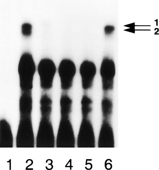 Fig. 2. Binding of nuclear proteins is specific. EMSA of nuclear extract derived from HepG2 cells bound to the −401T fragment in the presence of unlabeled DNA as competitor. Arrows 1 and 2 refer to the allele-specific factors. Lane 1, without extract; lane 2, 0.20 mg/mL of HepG2 extract in the absence of competitor; lanes 3 to 6, 0.20 mg/mL of HepG2 extract in the presence of 200-fold excess of unlabeled DNA as competitor. Competitors used were: −402A site (lane 3), WT site (lane 4), −401T site (lane 5), and nonrelated 30 bp fragment (lane 6).