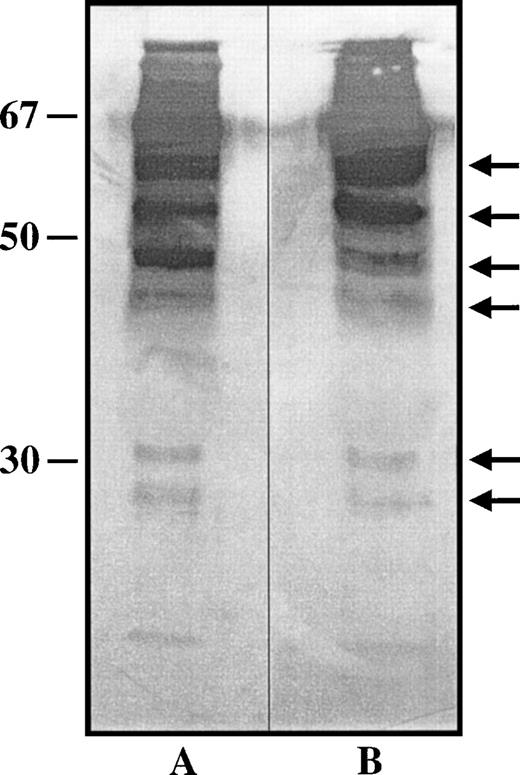 Fig. 3. Western immunoblot detection of plasma TM. Citrated murine plasma from TMwt/wt and TMcyt/cyt mice (lanes A and B, respectively) in Laemmli buffer was separated electrophoretically by SDS-PAGE under nonreducing conditions, and the gel was transferred to a nitrocellulose filter for immuno-detection of TM with specific monoclonal anti-TM antibodies, as detailed in Materials and Methods. Molecular weight markers are on the left. Several molecular forms of TM were identified, the most prominent of which are noted with arrows on the right. No differences in patterns between the two lanes could be discerned.