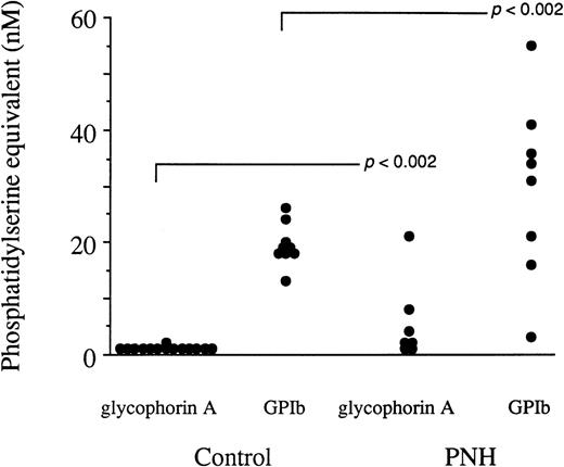 Fig. 2. The cellular origin of circulating microparticles in peripheral blood samples from PNH individuals and control subjects. The capture procedure involved insolubilized MoAbs to human glycophorin A, human GPIb, and irrelevant IgG1, the latter yielding control values that never exceeded 3 nmol/L phosphatidylserine equivalent and were subtracted from those reported in this figure. The assay of the phosphatidylserine content of captured particles is based on the ability of this phospholipid to promote the assembly of the prothrombinase enzyme complex. Each value is the mean of triplicate determinations. The means corresponding to the PNH samples were not significantly different from their control counterparts at the .05 level using the Student’s two-tailed t-test. Variances were also compared (using the ratio method) and the distribution of the values was shown to be different between the PNH and the control samples at the .002 level.