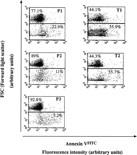 Fig. 4. Flow cytometry analysis of the shedding of membrane microparticles from PNH (P) and control (T) RBC after calcium ionophore treatment. Dot plot representations of AVFITC-labeled cell and particle suspensions. Cells have the highest forward scatter signal (FSC), whereas derived microparticles have a lower one. The proportion of events in each gate is indicated. Stimulation was achieved by 5 μmol/L calcium ionophore A23187 in the presence of 2 mmol/L external CaCl2 for 90 minutes at 37°C. Fluorescence intensity reflects the extent of AVFITC labeling of the population of interest, testifying to the degree of phosphatidylserine externalization. Each dot plot corresponds to 10,000 events and is representative of three experiments performed likewise.