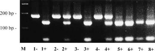 Fig. 3. Direct detection of missense mutation Arg513→ His in plasminogen exon 13 by RFLP analysis. Amplified PCR products of plasminogen exon 13 were digested with Mae III, electrophoresed in a 2% agarose gel, and visualized by ethidium bromide staining. The (uncut) mutant type PCR fragment has a size of 184 bp; the wild-type Mae III-digested PCR fragment has a size of 139 bp. −, no Mae III added to PCR product; +,Mae III added to PCR product. Lane M, 100-bp ladder; lane 1, father of patient no. 1; lane 2, mother of patient no. 1; lane 3, brother of patient no. 1; lane 4, patient no. 1; lanes 5 through 8, healthy controls. The larger (mutant type) allele is found afterMae III-digestion in patient no. 1 and his mother (lanes 2+ and 4+, heterozygous), but not in the father and the brother of patient no. 1 (lanes 1+ and 3+) and not in 4 healthy controls (lanes 5+, 6+, 7+, and 8+).
