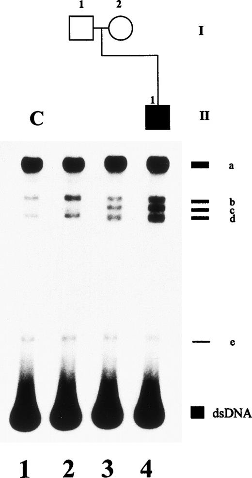Fig. 7. SSCP analysis of plasminogen gene exon 5 in patient no. 5 and his healthy parents. Radiolabeled single-stranded PCR products of plasminogen exon 5 were electrophoresed in a nondenaturing 5% polyacrylamide gel as described in Materials and Methods. Lane 1, healthy control (C); lane 2, father of patient no. 5; lane 3, mother of patient no. 5; lane 4, patient no. 5. dsDNA, double-stranded DNA.
