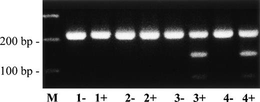 Fig. 8. Direct detection of missense mutation Leu128→ Pro in plasminogen exon 5 of patient no. 5 by RFLP analysis. Amplified PCR products of plasminogen exon 5 were digested withMsp I, electrophoresed in a 2% agarose gel, and visualized by ethidium bromide staining. The (uncut) wild-type PCR fragment has a size of 221 bp; the mutant Msp I-digested PCR fragment has a size of 144 bp. −, no Msp I added to PCR product; +,Msp I added to PCR product. Lane M, 100-bp ladder; lane 1, healthy control; lane 2, father of patient no. 5; lane 3, mother of patient no. 5; lane 4, patient no. 5. The shorter (mutant type) allele is found after Msp I-digestion in patient no. 5 and his mother (lanes 3+ and 4+, heterozygous), but not in his father (lane 2+) and not in a healthy control (lane 1+).