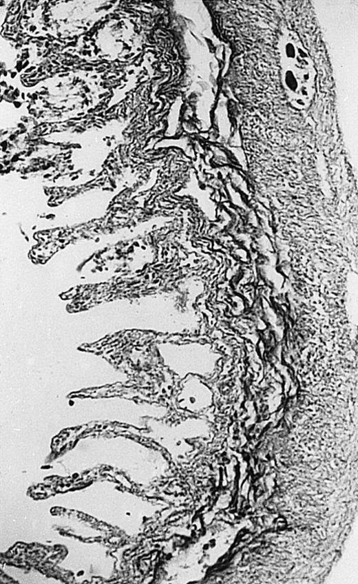Fig. 2. Histopathology of small intestinal mucosa cut in transection from an animal in each treatment group (study day 8). The upper panel (row 1) is a low power view (original magnification × 57); the lower panel (row 2) is a high power view (original magnification × 144). Note the diffuse thinning and necrosis of the mucosa with sloughing of intestinal epithelial cells in the control animal (A). There is progressive recovery of the thickness of the mucosa, reduction in inflammatory changes, and improved epithelial architecture with rhG-CSF (B), rhIL-11 (C), and combination therapy with rhG-CSF+IL-11 (D).