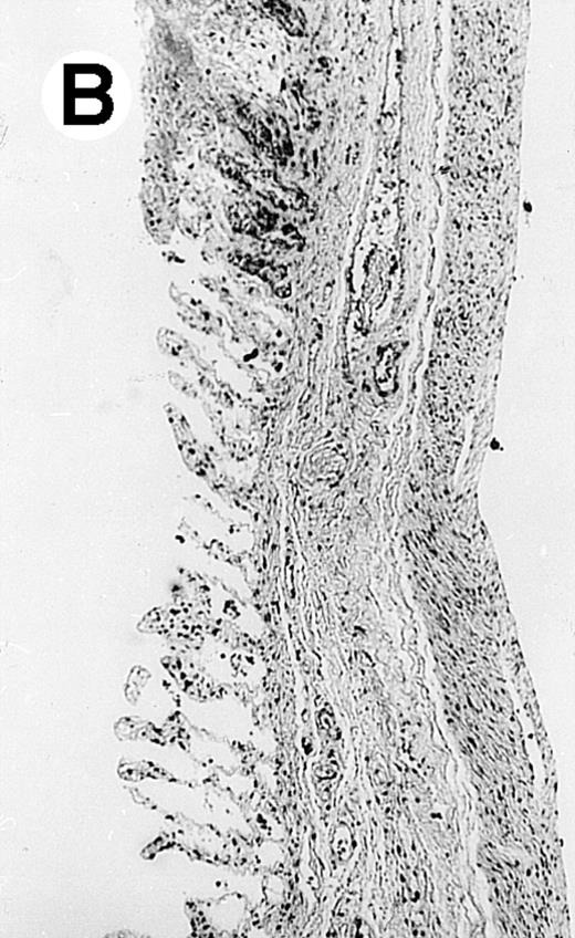 Fig. 2. Histopathology of small intestinal mucosa cut in transection from an animal in each treatment group (study day 8). The upper panel (row 1) is a low power view (original magnification × 57); the lower panel (row 2) is a high power view (original magnification × 144). Note the diffuse thinning and necrosis of the mucosa with sloughing of intestinal epithelial cells in the control animal (A). There is progressive recovery of the thickness of the mucosa, reduction in inflammatory changes, and improved epithelial architecture with rhG-CSF (B), rhIL-11 (C), and combination therapy with rhG-CSF+IL-11 (D).
