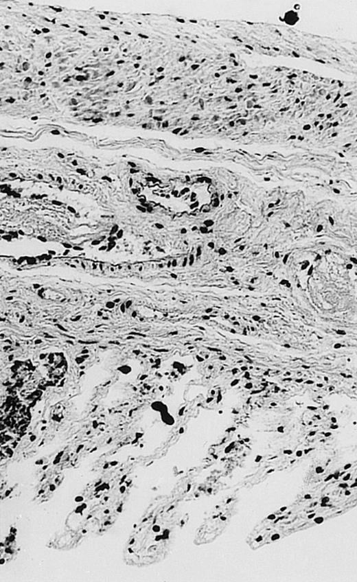 Fig. 2. Histopathology of small intestinal mucosa cut in transection from an animal in each treatment group (study day 8). The upper panel (row 1) is a low power view (original magnification × 57); the lower panel (row 2) is a high power view (original magnification × 144). Note the diffuse thinning and necrosis of the mucosa with sloughing of intestinal epithelial cells in the control animal (A). There is progressive recovery of the thickness of the mucosa, reduction in inflammatory changes, and improved epithelial architecture with rhG-CSF (B), rhIL-11 (C), and combination therapy with rhG-CSF+IL-11 (D).