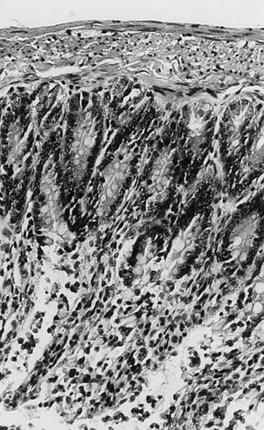Fig. 2. Histopathology of small intestinal mucosa cut in transection from an animal in each treatment group (study day 8). The upper panel (row 1) is a low power view (original magnification × 57); the lower panel (row 2) is a high power view (original magnification × 144). Note the diffuse thinning and necrosis of the mucosa with sloughing of intestinal epithelial cells in the control animal (A). There is progressive recovery of the thickness of the mucosa, reduction in inflammatory changes, and improved epithelial architecture with rhG-CSF (B), rhIL-11 (C), and combination therapy with rhG-CSF+IL-11 (D).