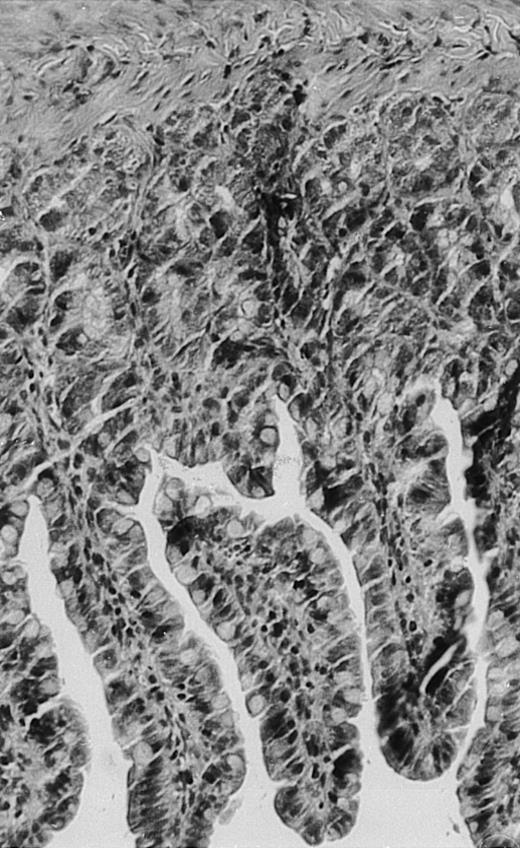 Fig. 2. Histopathology of small intestinal mucosa cut in transection from an animal in each treatment group (study day 8). The upper panel (row 1) is a low power view (original magnification × 57); the lower panel (row 2) is a high power view (original magnification × 144). Note the diffuse thinning and necrosis of the mucosa with sloughing of intestinal epithelial cells in the control animal (A). There is progressive recovery of the thickness of the mucosa, reduction in inflammatory changes, and improved epithelial architecture with rhG-CSF (B), rhIL-11 (C), and combination therapy with rhG-CSF+IL-11 (D).