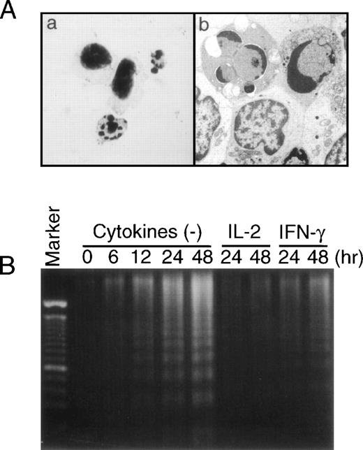 Fig. 4. Evidences of apoptotic cell death in EBV-infected NK leukemia cells. (A) Apoptotic NK leukemia cells 48 hours after the in vitro culture. Morphology of the apoptotic cells with May-Grünwald-Giemsa staining (original magnification × 1,000) (a) and with an electron microscopy (original magnification × 15,000) (b). (B) Fragmentation of DNA from NK leukemia cells (case no. 1) cultured in vitro. DNA ladder gradually became evident during the cultures in the absence of cytokines. The addition of either IFN-γ or IL-2 significantly inhibited the amounts of DNA fragmentation.