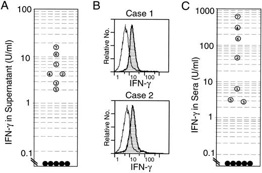 Fig. 6. Constitutive expression of IFN-γ in the EBV-infected NK leukemia cells. (A) Concentrations of IFN-γ in 24-hour culture supernatants of NK leukemia cells. The culture supernatants of NK leukemia cells (open circles 1 through 7) contained significant levels of IFN-γ, whereas those of normal NK cells did not (•). (B) Intracytoplasmic staining of IFN-γ in the NK leukemia cells on flow cytometric analysis. The cells were incubated with monensin (2 μmol/L) for 3 hours before the analysis. The majority of NK leukemia cells expressed intracytoplasmic IFN-γ protein. (C) Concentrations of IFN-γ in patients’ sera. Significant levels of serum IFN-γ were seen in all NK leukemia patients (○), whereas in normal controls (•), levels of IFN-γ were below detectable levels (<0.1 U/mL).