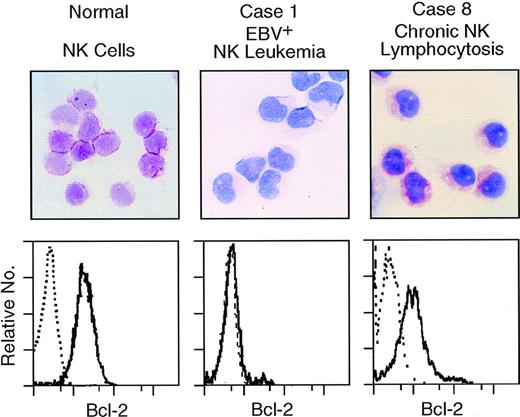 Fig. 2. Impaired expression of endogenous Bcl-2 in the EBV-infected NK leukemia cells. Analysis of Bcl-2 expression in either normal NK cells, NK leukemia cells, or NK cells from chronic NK lymphocytosis on immunohistochemical (upper panels) and flow cytometric (lower panels) analyses. On both assays, endogenous Bcl-2 was undetectable in NK leukemia cells, although NK cells from normal controls and a case of chronic NK lymphocytosis constitutively expressed Bcl-2. On the immunohistochemical method, Bcl-2 is visualized as diffuse red staining in cytoplasm in normal NK cells and chronic NK lymphocytosis (upper left and right panels). Results are summarized in Table 2.