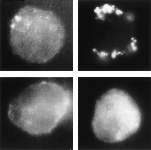 Fig. 9. Distribution of CD11b on the neutrophil surface after cross-linking of CD66b. Upper left panel, neutrophil exposed to FITC-conjugated anti-CD11b MoAb; upper right panel, neutrophil exposed to anti-CD66b MoAb before incubation with a second step goat-F(ab2’) fragment against mouse MoAbs to cross-link CD66b and labeled with FITC-conjugated anti-CD11b MoAb; lower left panel, neutrophil treated as in the upper right panel, but in the presence of 100 mmol/L D-mannose; lower right panel, neutrophil exposed to anti-CD66b MoAb before incubation with a second step goat-F(ab2′) fragment against mouse MoAbs to cross-link CD66b and labeled with FITC-conjugated anti-CD10 MoAb.