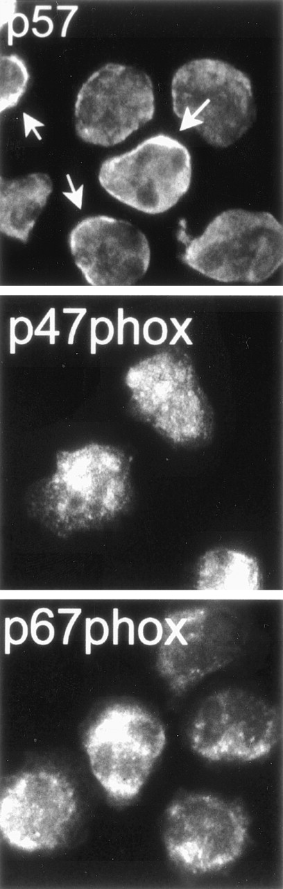 Fig. 1. Localization of neutrophil proteins by fluorescence microscopy. Adherent PMNs were fixed and permeabilized and then stained with MoAbs to p57 or affinity-purified pAbs to p47phox or p67phox as indicated followed by secondary antibodies conjugated to FITC. p47phox and p67phox were diffusely distributed throughout the cytosol, and p57 was distributed throughout the cytosol and plasma membrane (arrows).