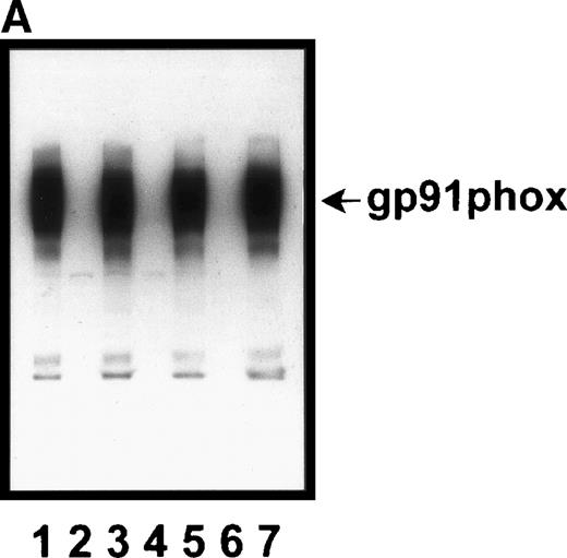 Fig. 5. Transient enrichment of p47phox on OpZ phagosomes in X-linked CGD neutrophils. (A) gp91phox is undetectable in X-linked CGD neutrophils. PMN proteins from four normal individuals (odd lanes) or three persons with X-linked CGD (AlS, MK, TB, even lanes) were resolved by SDS-PAGE and then immunoblotted with antibody to gp91phox as described in Materials and Methods. Individuals deficient in gp91phox also lacked detectable p22phox(data not shown). (B and C) Kinetics of p47phox association with OpZ phagosomes in X-linked CGD neutrophils. Adherent X-linked CGD PMNs ingested OpZ for 0 to 15 minutes before processing for IFM. Fixed cells were double-stained with MoAb to p57 and pAb to p47phoxfollowed by secondary antibodies coupled to Texas red or FITC, respectively. (B) Representative fluorescence data for X-linked CGD PMNs. Data shown are from MK. Note that p47phox was enriched on forming phagosomes, but was not retained on these structures once particle internalization was complete. Arrows, phagosomes. (C) Pooled data (mean ± SD) for PMNs isolated from six persons with X-linked CGD (TS, DS, MK, TB, AlS, and HB). All samples were assayed in duplicate or triplicate and at least 100 phagosomes were scored/sample/time. (•), p57; (○), p47phox.