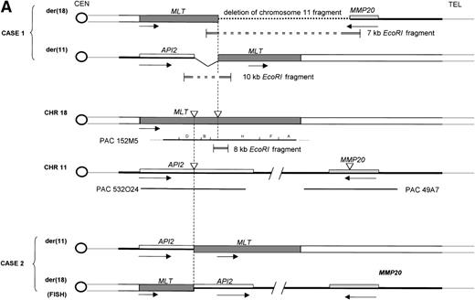 Fig. 2. Molecular structure of the t(11;18). The genomic structure of the t(11;18) is shown in (A). In the center the MLT gene is shown as the darkly shaded area on the normal 18q; API2 andMMP20 are shown, respectively, as an open rectangle and a light gray rectangle on the normal 11q (not drawn to scale). Below each gene the PAC isolated for this gene is shown. For PAC 152M5 the position of the different BamHI fragments used for FISH experiments are indicated. On top the rearrangement in case 1 is illustrated: the der(11) fuses the 5′ end of API2 to the 3′ end of MLT,while on the der(18), as a result from the cryptic deletion of chromosome 11, the 5′ end of MLT is fused to the 5′ end ofMMP20. The transcriptional orientation of each gene is indicated by an arrow below each chromosome, showing that on the der(18) MLT and MMP20 do have an opposite transcriptional orientation. The genomic fusion fragments that were cloned from, respectively, the der(11) and the der(18) are indicated by the double lines. Below, the rearrangement of case 2 is shown: the der(11) fuses 5′ API2 to 3′ MLT. The breakpoint in API2 is identical to the one in case 1; the breakpoint in MLT occurred upstream of the breakpoint in case 1 (see 2B). FISH experiments suggest that the der(18) is the balanced reciprocal of the der(11). The localization of all breakpoints is indicated on the normal chromosomes by open triangles. (B) The structure of the different fusion cDNAs. On top the structure of API2 is shown with three aminoterminal BIR domains separated from the carboxyterminal RING domain by a CARD domain. TheAPI2 cDNA is truncated after the third BIR domain and fused in frame to MLT. As a result of the heterogeneity of the genomic breakpoints in case 2, 582 additional nucleotides, encoding two Ig-like C2 domains of MLT, are present in this fusion. An Ig gamma VDJ4-like sequence in MLT is shown by a cross-hatched box. The sequence and the translation of the different junction fragments is shown underneath each cDNA.