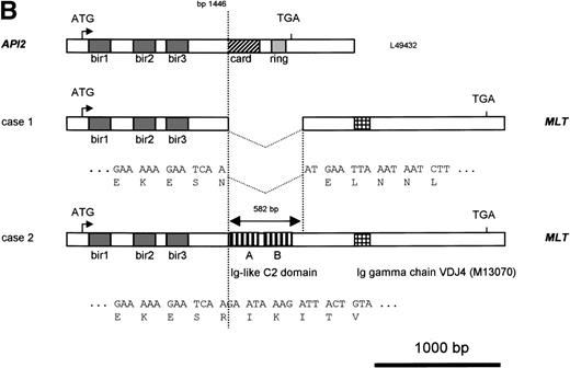 Fig. 2. Molecular structure of the t(11;18). The genomic structure of the t(11;18) is shown in (A). In the center the MLT gene is shown as the darkly shaded area on the normal 18q; API2 andMMP20 are shown, respectively, as an open rectangle and a light gray rectangle on the normal 11q (not drawn to scale). Below each gene the PAC isolated for this gene is shown. For PAC 152M5 the position of the different BamHI fragments used for FISH experiments are indicated. On top the rearrangement in case 1 is illustrated: the der(11) fuses the 5′ end of API2 to the 3′ end of MLT,while on the der(18), as a result from the cryptic deletion of chromosome 11, the 5′ end of MLT is fused to the 5′ end ofMMP20. The transcriptional orientation of each gene is indicated by an arrow below each chromosome, showing that on the der(18) MLT and MMP20 do have an opposite transcriptional orientation. The genomic fusion fragments that were cloned from, respectively, the der(11) and the der(18) are indicated by the double lines. Below, the rearrangement of case 2 is shown: the der(11) fuses 5′ API2 to 3′ MLT. The breakpoint in API2 is identical to the one in case 1; the breakpoint in MLT occurred upstream of the breakpoint in case 1 (see 2B). FISH experiments suggest that the der(18) is the balanced reciprocal of the der(11). The localization of all breakpoints is indicated on the normal chromosomes by open triangles. (B) The structure of the different fusion cDNAs. On top the structure of API2 is shown with three aminoterminal BIR domains separated from the carboxyterminal RING domain by a CARD domain. TheAPI2 cDNA is truncated after the third BIR domain and fused in frame to MLT. As a result of the heterogeneity of the genomic breakpoints in case 2, 582 additional nucleotides, encoding two Ig-like C2 domains of MLT, are present in this fusion. An Ig gamma VDJ4-like sequence in MLT is shown by a cross-hatched box. The sequence and the translation of the different junction fragments is shown underneath each cDNA.