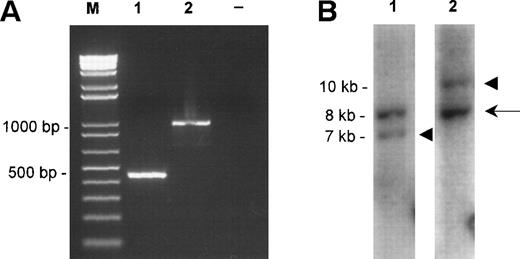 Fig. 5. Molecular characterization of the fusions. (A) TheAPI2-MLT products obtained by RT-PCR from case 1 (lane 1) and case 2 (lane 2). Size markers (M) are shown on the left, the negative control (−) is shown on the right. (B) The Southern blot detecting the rearranged EcoRI fragments of case 1. The probes were derived from an 8-kb EcoRI clone from chromosome 18 spanning the breakpoint (see Fig 2A, center). Lane 1 shows hybridization with the probe derived proximally to the breakpoint, lane 2 shows hybridization with the probe derived distally to the breakpoint. The arrow shows the normal 8-kb EcoRI fragment, the arrowheads show the chimeric fragments of, respectively, 7 kb, derived from the der(18) and 10 kb, originating from the der(11).