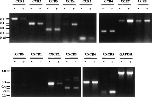 Fig. 3. Chemokine receptor expression profile in DC. Total RNA was prepared from DC after 8 days of culture, either untreated (−) or treated with MCM (+) from days 5-8. First-strand cDNA were synthesized and used in semi-quantitative PCR analysis. PCR products from 30 cycles of amplification were visualized on an ethidium-bromide–stained 2% agarose gel. Molecular-weight markers (in kb) are shown to the left of the gels. The annealing temperatures for all PCR reactions were 55°C except for CCR5, CCR6, CCR9, CXCR3, CXCR5, CX3CR1, which were at 60°C. These results are representative of seven or more experiments using three independent pairs of cDNA.