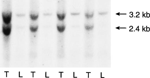 Fig. 3. Southern blot analysis of tissues from Nf1+/− mice with MPD. The 3.2-kb restriction fragment corresponds to the targeted Nf1 allele, and the 2.4-kb band is derived from the wild-type allele. DNA extracted from the bone marrows or spleens of five mice with leukemia (L) show absence or a marked reduction in the wild-type Nf1 allele compared to paired tail (T) DNA specimens.