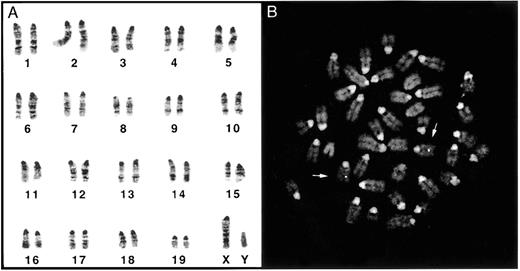 Fig. 4. (A) Cytogenetic analysis of spleen cells from a CY-treated mouse with LOH at Nf1 shows a normal diploid karyotype. (B) FISH of the same specimen shown in (A) with a genomicNf1 probe shows 1 copy of the gene on each chromosome 11 homolog.