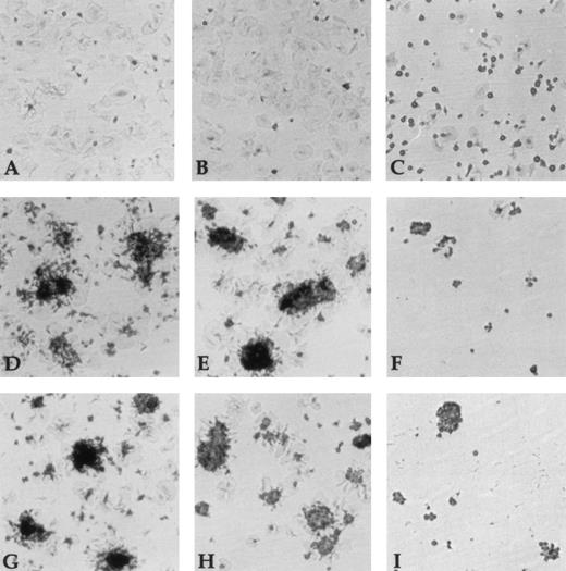 Fig. 6. Inhibition of platelet adhesion to vWF and Fg. Wells were coated for 2 hours at 37°C with 10 μg/mL of vWF or Fg. The protein-coated wells were incubated with buffer (A, D, G), anti-RGD depleted Ig fraction (1.3 μmol/L) (B, E, H) or anti-RGD Ig (1.3 μmol/L) (C, F, I) for 1 hour at 37°C. Unstimulated platelets (A-C) and thrombin-stimulated platelets (D-I) were allowed to adhere to Fg-coated wells (A-F) or vWF-coated wells (G-I) for 20 minutes at room temperature. After removal of nonadherent platelets, adherent platelets were fixed, stained, and microphotographed at a 40-fold magnification.