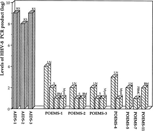 Fig. 2. Indirect estimation of HHV-8 viral load in tissues by end-point dilution of final HHV-8 N-PCR1′ product obtained with a linear amplification procedure, in Kaposi’s sarcoma (KS) samples from three AIDS patients (AIDS-1 to AIDS-3), and in lymph nodes (LN), spleen (S), bone marrow (BM), PBMC, and myeloma (Myel) samples from POEMS patients with (POEMS-1 to POEMS-7) or without (POEMS-11) multicentric Castleman’s disease.