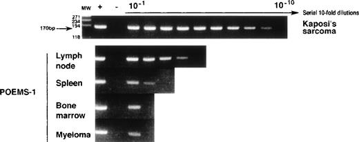 Fig. 3. Vizualization by electrophoresis on a 2% agarose/ethidium bromide gel of serial 10-fold dilutions of final HHV-8 N-PCR1′ amplified products in Kaposi’s sarcoma (KS) sample from AIDS-1, and in lymph node (LN), spleen (S), bone marrow (BM), and myeloma (Myel) samples from POEMS-1. The molecular size (in base pairs, bp) of the expected amplified product for HHV-8 ORF26 (170 bp) and molecular-weight markers (100-bp DNA ladder; GIBCO-BRL, Gaithersburg, MD) are indicated on the left.