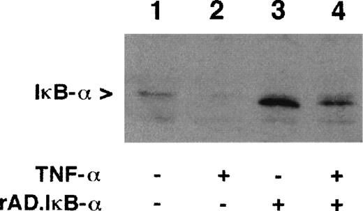 Fig. 1. Expression of IκB- in HUVEC. Confluent HUVEC were left untreated (lanes 1 and 2), infected with rAd.IκB- (moi 100; lanes 3 and 4), and/or stimulated with TNF- for 1 hour (100 U/mL; lanes 2 and 4). Cell lysates were separated by 12.5% SDS-PAGE and Western blot was performed with MoAb to IκB-. Shown is a representative experiment.