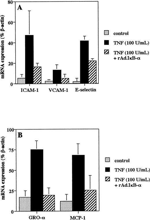 Fig. 2. Adenoviral IκB- transfer inhibits TNF-–induced endothelial adhesion molecule and chemokine mRNA expression. Cells were left untreated, infected with rAd.IκB-, and/or stimulated with TNF- (100 U/mL) for 4 hours. RT-PCR was performed using specific primers for ICAM-1, VCAM-1, and E-selectin (A); for MCP-1 and GRO- (B); and for β-actin. Quantification was perfomed by HPLC analysis, and mRNA expression was reported as the percentage of β-actin serving as an internal standard. Data are the mean ± SD of three separate experiments.