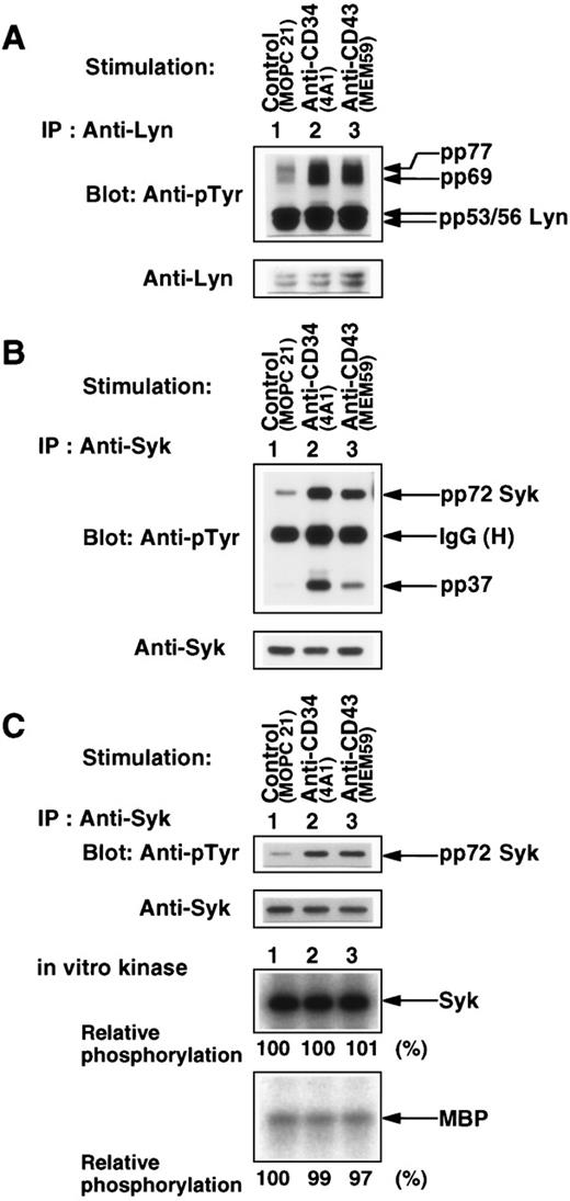 Fig. 9. Characterization of tyrosine-phosphorylated proteins. (A and B) Western blots of Lyn and Syk immunoprecipitated with anti-Lyn (A) or anti-Syk (B) from Triton X-100 lysates of KG1a cells stimulated for 30 minutes with MOPC21 (control, lane 1), 4A1 (lane 2), or MEM59 (lane 3) as described in the legend to Fig 1, probed with anti-pTyr (top panels), and reprobed with anti-Lyn (A, bottom panel) or anti-Syk (B, bottom panel). IgG (H), heavy chain of immunoglobulin G. (C) (Top two panels) Western blots of modified RIPA-washed Syk immunoprecipitates from Triton X-100 lysates prepared as described above, probed with anti-pTyr, and reprobed with anti-Syk. (Bottom two panels) Autoradiograms of in vitro phosphorylation of Syk and MBP by aliquots of the modified RIPA-washed Syk immunoprecipitates. Syk kinase activities were determined by measuring the incorporation of32PO4 into Syk per se and MBP and expressed as values relative to the specific activity of Syk in the control sample (lane 1).