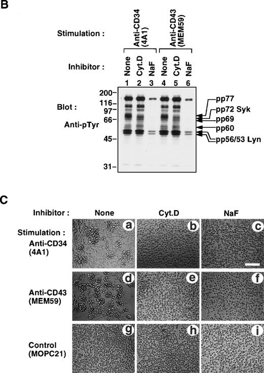 Fig. 11. (A) Inhibition of antibody-induced cap formation. (A) Distribution of CD34 or CD43 on KG1a cells stimulated for 30 minutes with anti-CD34 (4A1, a through l) or anti-CD43 (MEM59, m through x) in the presence of medium alone (a through d, m through p), Cyt.D (e through h, q through t), or NaF (i through l, u through x) as described in Materials and Methods. After fixation, cells were double-stained either with anti-CD34 (green channel: b, f, and j) and phalloidin (red channel: c, g, and k) or with anti-CD43 (green channel: n, r, and v) and phalloidin (red channel: o, s, and w), and then analyzed by Nomarski differential-interference-contrast (left-hand panels) and confocal immunofluorescence microscopy. The right-hand panels show superimposed images of green and red channels. Bars, 10 μm. (B) Anti-pTyr Western blot of equal amounts of Triton X-100 lysates from KG1a cells stimulated with anti-CD34 (lanes 1 through 3) or anti-CD43 (lanes 4 through 6) in the presence of medium alone (lanes 1 and 4), 10 μg/mL cytochalasin D (Cyt.D) (lanes 2 and 5), or 30 mmol/L NaF (lanes 3 and 6) as described above. Molecular size markers are indicated on the left (kD). (C) Homotypic cytoadhesion of KG1a cells stimulated for 90 minutes with anti-CD34 (a through c), anti-CD43 (d through f), or control antibody (g through i) in the presence of medium alone (a, d, and g), 10 μg/mL Cyt.D (b, e, and h), or 30 mmol/L NaF (c, f, and i). Bars, 80 μm.