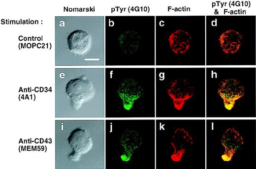 Fig. 8. Localization of phosphotyrosine in KG1a cells after stimulation. KG1a cells were stimulated for 30 minutes with anti-CD34 (4A1), anti-CD43 (MEM59), or MOPC21 (control) as described in the legend to Fig 1. After fixation and permeabilization, cells were double-stained with anti-pTyr (green channel: b, f, and j) and phalloidin (red channel: c, g, and k), and analyzed by Nomarski differential-interference-contrast (left-hand panels) and confocal immunofluorescence microscopy. The right-hand panels show superimposed images of green and red channels. Bars, 5 μm.