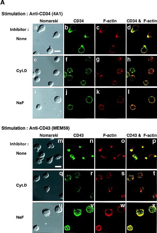 Fig. 11. (A) Inhibition of antibody-induced cap formation. (A) Distribution of CD34 or CD43 on KG1a cells stimulated for 30 minutes with anti-CD34 (4A1, a through l) or anti-CD43 (MEM59, m through x) in the presence of medium alone (a through d, m through p), Cyt.D (e through h, q through t), or NaF (i through l, u through x) as described in Materials and Methods. After fixation, cells were double-stained either with anti-CD34 (green channel: b, f, and j) and phalloidin (red channel: c, g, and k) or with anti-CD43 (green channel: n, r, and v) and phalloidin (red channel: o, s, and w), and then analyzed by Nomarski differential-interference-contrast (left-hand panels) and confocal immunofluorescence microscopy. The right-hand panels show superimposed images of green and red channels. Bars, 10 μm. (B) Anti-pTyr Western blot of equal amounts of Triton X-100 lysates from KG1a cells stimulated with anti-CD34 (lanes 1 through 3) or anti-CD43 (lanes 4 through 6) in the presence of medium alone (lanes 1 and 4), 10 μg/mL cytochalasin D (Cyt.D) (lanes 2 and 5), or 30 mmol/L NaF (lanes 3 and 6) as described above. Molecular size markers are indicated on the left (kD). (C) Homotypic cytoadhesion of KG1a cells stimulated for 90 minutes with anti-CD34 (a through c), anti-CD43 (d through f), or control antibody (g through i) in the presence of medium alone (a, d, and g), 10 μg/mL Cyt.D (b, e, and h), or 30 mmol/L NaF (c, f, and i). Bars, 80 μm.
