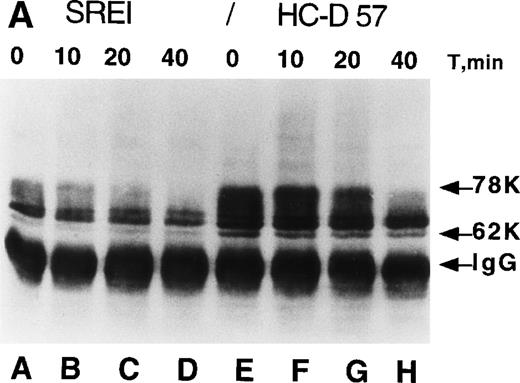 Fig. 2. Processing and expression of c-Kit and EPOR in HCD57 and HCD57-SREI cells. (A) HCD57 cells deprived of EPO overnight (lanes A through D) or HCD57-SREI cells cultured without EPO (lanes D through G) were left untreated (lanes A and E), or treated with 10 U EPO/mL for the indicated times at 37°C. The cells were rapidly cooled, and the forms of EPOR present were determined by immunoprecipitation of the EPOR and detection of the receptor proteins using the same affinity-purified anti-COOH terminal, anti-EPOR IgG. The form of EPOR between 62 and 78 kD are marked (upper arrows). The IgG on the gel from the heavy chain of anti-EPOR present in the immunoprecipitates is also indicated (lower arrow). (B) HCD57-SREI cells exhibit upregulated cell-surface c-Kit expression. HCD57 and HCD57-SREI cells were incubated with an FITC-conjugated c-Kit antibody and detected using flow cytometry. HCD57-SREI cells exhibit 81.4% more cell surface c-Kit (peak C) than HCD57 (peak B). Peak A represents background staining (CD4).