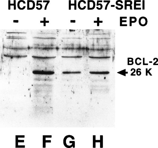 Fig. 3. Bcl-Xl and Bcl-2 are maintained in HCD57-SREI cells when EPO is withdrawn. HCD57 cells (lanes A, B, E, and F) and HCD57-SREI cells (lanes C, D, G, and H) were cultured for 72 hours in either medium containing 1 U EPO/mL (lanes B, D, F, H) or no EPO (lanes A, C, E, G). Ten micrograms of cellular protein was analyzed by Western blotting using anti-Bcl-Xl (lanes A through D) or anti–Bcl-2 (lanes E through H) antisera. The proteins of interest were visualized with ECL and are marked by an arrow.