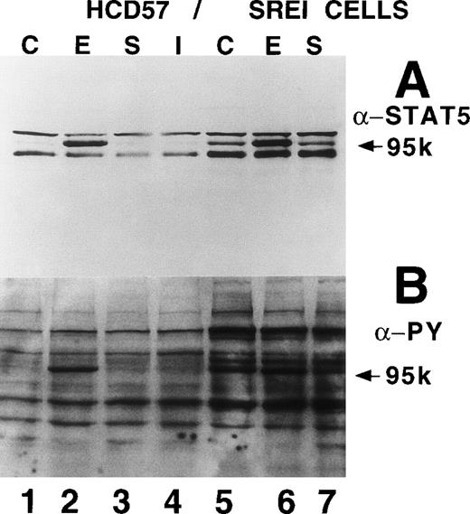 Fig. 5. Characterization of nuclear extracts made from EPO- and SCF-treated HCD57 (lanes 1 through 4) and HCD57-SREI cells (lanes 5 through 7). Cells (2 × 107) were treated with nothing (lanes 1 and 5), EPO (10 U/mL) (lanes 2 and 6), interferon-γ (5 ng/mL) (lane 4), or SCF (100 ng/mL) (lanes 3 and 6) for 10 minutes at 37°C. The immunoblot was probed with MoAb to STAT5 (A) and reprobed with MoAbs to PY (B). The 95K arrows mark the molecular weight and position where the STAT5 proteins migrate on the gel. (C) Mobility-shift assays of the PIE binding nuclear proteins from EPO and SCF treatment. Nuclear protein preparation and gel shift analyses with the PIE sequence were performed as previously described.11 Nuclear protein (20 μg) from control (C) lanes 1 and 5, and EPO-treated extracts (lanes 2 and 6) and SCF-treated cells (lanes 3 and 7) were incubated with the radiolabeled oligonucleotide, and shifted bands were visualized by autoradiography. Only upon a very dark exposure can a minor band below the position of the major band be seen that arises from STAT1 binding in either EPO- or interferon-treated HCD57 cells. The HCD57 cells seem to be very unresponsive to interferon-γ compared with primary erythroid cells. (D) Super-shift analysis shows that STAT5A/B heterodimers are the constitutively active DNA-binding proteins. The cells were treated as before, or left untreated and the gel mobility shift assay was performed as above except that either anti-STAT1, anti-STAT3, anti-STAT5A, or anti-STAT5B were preincubated for 15 minutes on ice with the nuclear extracts before the addition of the radiolabeled PIE DNA. The bar indicates the supershift of DNA binding that occurred with either anti-STAT5A or anti-STAT5B antisera. The deduced positions of apparent shifts resulting from either STAT5A:STAT5B heterodimers (STAT5A:B), STAT5A homodimers (STAT5A:A), or STAT5B homodimers (STAT5B:B) are indicated by arrows.