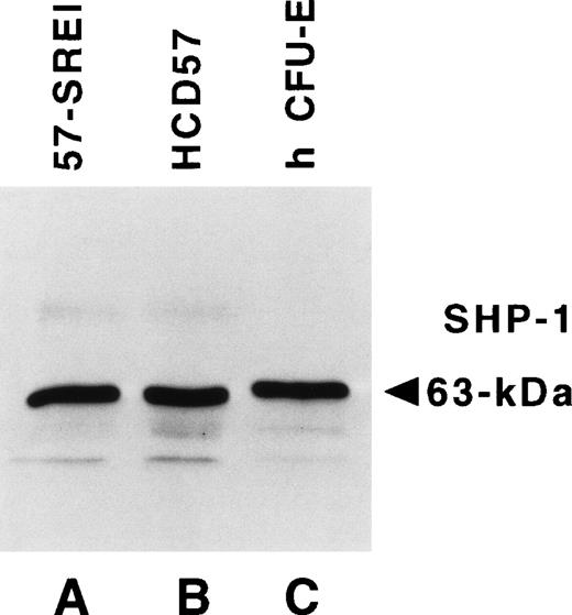 Fig. 6. The tyrosine protein phosphatase, SHP-1, is equally expressed in HCD57, HCD57-SREI cells and primary human erythroid cells. Frozen HCD57 and HCD57-SREI cells were sent to Dr Amittha Wickrema who compared 10 μg of total cellular protein from these cell lines with an equal amount of primary erythroid cells at the CFU-E stage of development that develop in culture from more immature erythroid cells purified from human blood. The Western blot was probed with anti–SHP-1 antiserum and visualized by ECL.