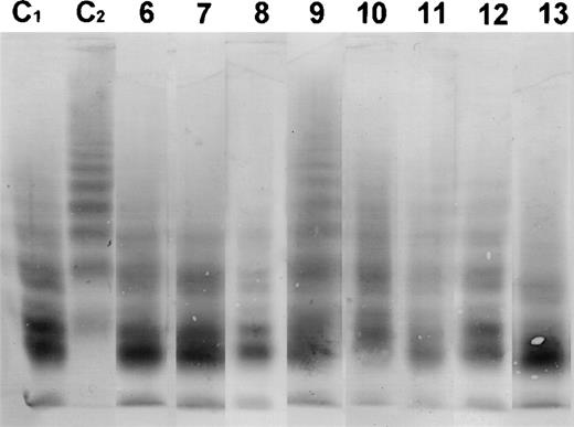 Fig. 3. Western blot of the multimeric pattern of vWF R834Q after incubation with plasma from patients suffering from BMT-associated TTP. C1, plasma from a healthy donor incubated with vWF R834Q. C2, plasma from a healthy donor incubated with vWF R834Q in the presence of EDTA (1 mmol/L). Lanes 6 through 13, patient plasmas (numbers as in Table1).