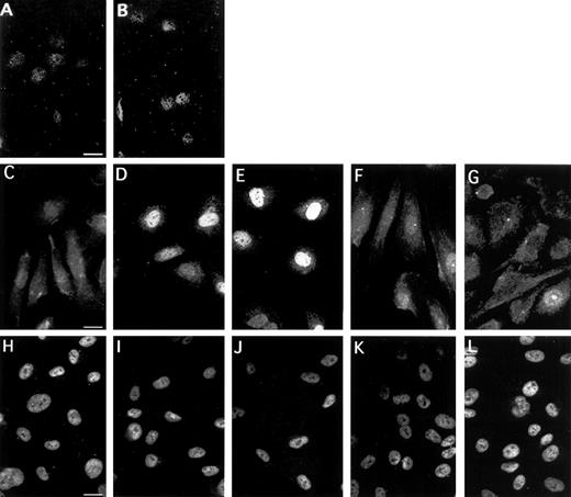 Fig. 10. Subcellular localization of EGR-1 and Sp1 in HUVEC. Immunofluorescence staining of EGR-1 in unstimulated endothelial cells (C) and cells stimulated with VEGF for 15 minutes (D), 1 hour (E), 6 hours (F), and 8 hours (G). Preabsorbtion of the anti–EGR-1 antibodies with an appropriate peptide abolished both cytoplasmic and nuclear staining of unstimulated (A) and VEGF-stimulated cells (B). Sp1 staining was exclusively nuclear and identical for all time points (H through L). The picture is representative of four experiments with similar results.