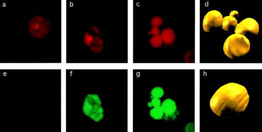 Fig. 1. Detection of apoptosis in CEC. The criteria used to assess apoptosis are illustrated for CEC stained for DNA with EthD-1 (a, b, and c) and by TUNEL assay for DNA fragmentation (e, f, and g). The CEC on the left is normal and nonapoptotic, as evidenced by normal pattern of chromatin staining (a) and negative result in TUNEL assay (e). The CEC in the middle shows evidence of early apoptosis with some chromatin condensation (b) and TUNEL positivity (f). A CEC that is frankly apoptotic has marked chromatin fragmentation and condensation (c) and strong TUNEL positivity (g). These images were acquired by confocal microscopy, after which we constructed three-dimensional images from multiple sections (d and h) to highlight the difference between the nucleus of a normal (h) versus an apoptotic (d) CEC.