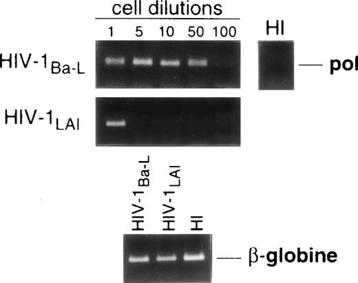Fig. 2. Nested PCR detection of viral DNA in HIV-infected immature DC. Culture day 8 sorted CD1a+ DC were exposed 1 day later to 500 TCID50 of HIV-1Ba-L or HIV-1LAI. Relative HIV DNA content was assessed 48 hours PI by limiting dilutions of infected cell lysates in uninfected A301 cell lysates. DC that had been exposed to heat-inactivated (HI) virus were used as negative controls and assayed undiluted. β-Globin DNA level was assessed as amplification and DNA content control. The PCR sensitivity was 1 copy/3 × 104 cells, as determined in parallel experiments by serial dilutions of 8E5/LAV cells (1 copy/cell) in HIV− A301 parental cells (data not shown). Results of one of four experiments.