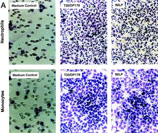 Fig. 1. Induction of phagocyte migration by T20/DP178. Different concentrations of T20/DP178 were placed in the lower wells of the chemotaxis chamber; cell suspension was placed in the upper wells. The upper and lower wells were separated by polycarbonate filters. After incubation, the cells migrated across the filters were stained and counted. (A) Migration of neutrophils (upper panel) and monocytes (lower panel) across the filters in response to 100 nmol/L T20/DP178 or fMLP (original magnification × 200). (B) Fold increase of leukocyte migration in response to T20/DP178 over control medium. (C) Inhibition of monocyte migration in response to T20/DP178 by pretreatment of the cells with pertussis toxin (PT; 100 ng/mL for 30 minutes at 37°C). CT, cholera toxin.