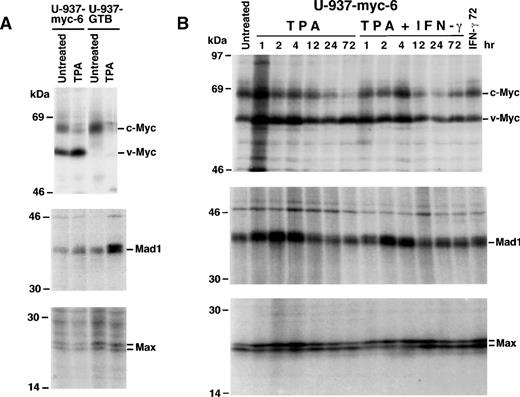 Fig. 2. Myc, Mad, and Max protein synthesis in U-937-myc-6 and U-937-GTB cells. (A) U-937-myc-6 and U-937-GTB cells were treated with TPA for 3 days before 35S-methionine labeling. High stringency lysates were immunoprecipitated with pan-Myc (IG-13), Mad1 (C-19), and Max (C17) antibodies and analyzed by SDS-PAGE. (B) Time course of Myc, Mad1, and Max proteins synthesis during stimulation of U-937-myc-6 cells. TPA, IFN-γ, or TPA + IFN-γ were added for the time indicated and the proteins were analyzed as in (A).