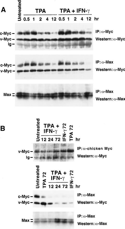Fig. 5. Western blot analysis of total Myc and Myc:Max complexes during induced differentiation of U-937-myc-6 cells. (A) Early kinetics of TPA- and TPA + IFN-γ–stimulation for the times indicated. (B) Late kinetics of TPA- and/or IFN-γ–stimulation. Upper panels: analysis of total Myc expression. (A) v- plus c-Myc and (B) v-Myc were immunoprecipitated from low stringency lysates by rabbit pan-Myc antibodies (IG-13) or rabbit chicken Myc-specific antibodies (5042), respectively, followed by Western analysis using monoclonal pan-Myc antibodies (C-33). Middle and lower panels: analysis of Myc:Max complexes and Max expression, respectively. Aliquots of the same lysates as in the upper panels were immunoprecipitated by using C17 Max antibodies followed by Western analysis of coimmunoprecipitated Myc (middle panel) and of Max (lower panel). Equal amounts of protein were immunoprecipitated for each lane. The figure shows representative results from 1 of 4 independent experiments.
