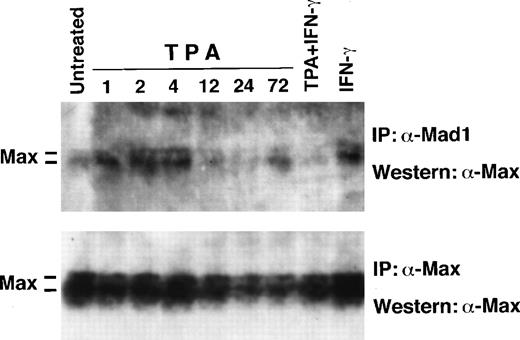 Fig. 6. Western blot analysis of total Max and of Mad1:Max complexes during induced differentiation of U-937-myc-6 cells. U-937-myc-6 cells were induced with TPA, IFN-γ, or TPA + IFN-γ for the times indicated. (Upper panel) Max was coimmunoprecipitated from low stringency lysates using C19 Mad1 antibodies followed by Western blot analysis of Max by using C17 Max antibodies (Lower panel). Max was immunoprecipitated from aliquots of the same lysates with C17 Max antibodies followed by immunoblot analysis using the same antibodies.